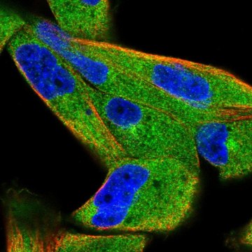 Anti-SPAG9 antibody produced in rabbit Prestige Antibodies&#174; Powered by Atlas Antibodies, affinity isolated antibody