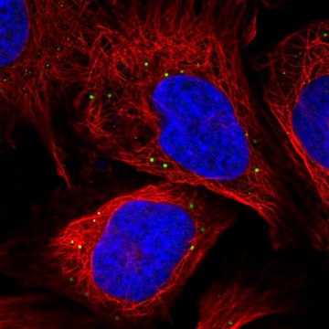 Anti-NAA35 antibody produced in rabbit Prestige Antibodies&#174; Powered by Atlas Antibodies, affinity isolated antibody