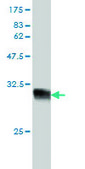 Monoclonal Anti-HCAP-G antibody produced in mouse clone 4B1, purified immunoglobulin, buffered aqueous solution
