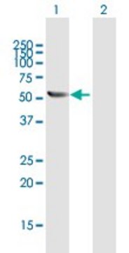 Anti-TBCE antibody produced in rabbit purified immunoglobulin, buffered aqueous solution