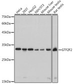 Anti-GTF2F2 Antibody, clone 3T7Q9, Rabbit Monoclonal