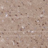 Anti-EXOG antibody produced in rabbit Prestige Antibodies® Powered by Atlas Antibodies, affinity isolated antibody