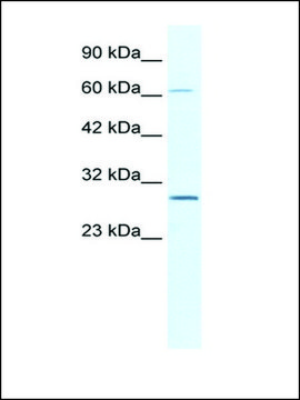 Anti-PARP11 antibody produced in rabbit affinity isolated antibody