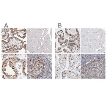 Anti-SMARCC1 antibody produced in rabbit Prestige Antibodies&#174; Powered by Atlas Antibodies, affinity isolated antibody, buffered aqueous glycerol solution