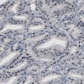 Monoclonal Anti-NOP56 antibody produced in mouse Prestige Antibodies® Powered by Atlas Antibodies, clone CL2603, purified immunoglobulin, buffered aqueous glycerol solution