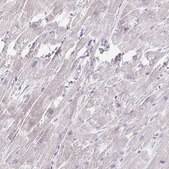 Anti-MYLK2 antibody produced in rabbit Prestige Antibodies® Powered by Atlas Antibodies, affinity isolated antibody, buffered aqueous glycerol solution