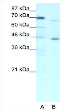 Anti-ESR2 antibody produced in rabbit affinity isolated antibody