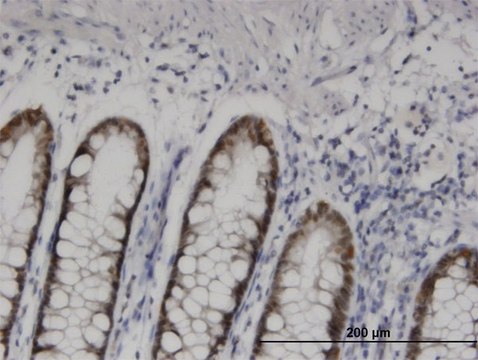 Monoclonal Anti-HOXD11, (N-terminal) antibody produced in mouse clone 6C8, purified immunoglobulin, buffered aqueous solution