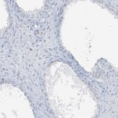 Anti-SCML1 antibody produced in rabbit Prestige Antibodies® Powered by Atlas Antibodies, affinity isolated antibody, buffered aqueous glycerol solution