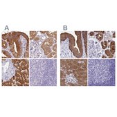 Anti-HGD antibody produced in rabbit Prestige Antibodies® Powered by Atlas Antibodies, affinity isolated antibody, buffered aqueous glycerol solution