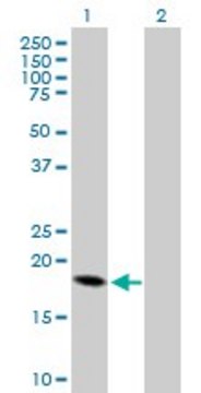 Anti-CRH antibody produced in mouse purified immunoglobulin, buffered aqueous solution