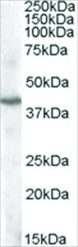 Anti-PITX3 antibody produced in goat affinity isolated antibody, buffered aqueous solution