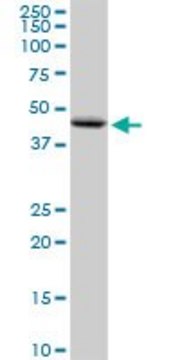 Anti-PNPLA3 antibody produced in rabbit purified immunoglobulin, buffered aqueous solution