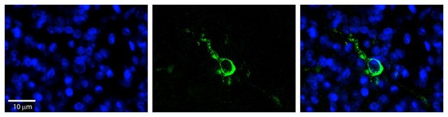 Anti-LPIN1 antibody produced in rabbit affinity isolated antibody