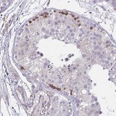 Anti-TMEM8C antibody produced in rabbit Prestige Antibodies® Powered by Atlas Antibodies, affinity isolated antibody, buffered aqueous glycerol solution
