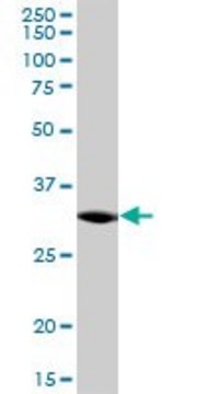 Anti-C21ORF59 antibody produced in mouse purified immunoglobulin, buffered aqueous solution