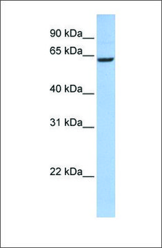 Anti-CCDC67 antibody produced in rabbit affinity isolated antibody