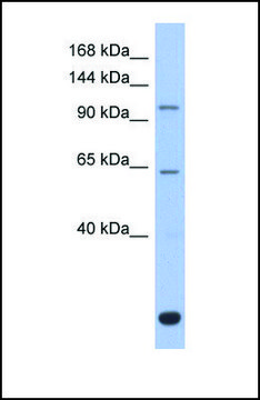 Anti-BACH2 antibody produced in rabbit affinity isolated antibody