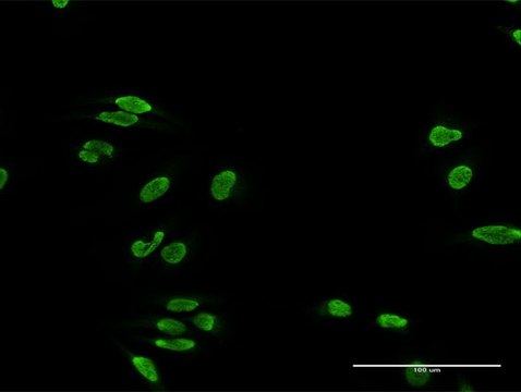 Anti-TDP1 antibody produced in rabbit purified immunoglobulin, buffered aqueous solution