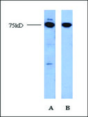 Anti-EGR2 antibody produced in rabbit affinity isolated antibody