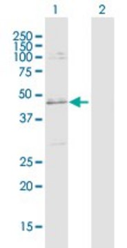 Anti-SLC25A31 antibody produced in rabbit purified immunoglobulin, buffered aqueous solution