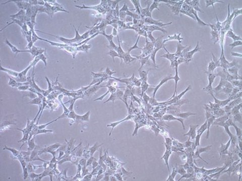 GT1-7小鼠下丘脑GnRH神经元细胞系 GT1-7 cells can be used as an in vitro model of GnRH-secreting neurons of the hypothalamus.