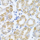 Anti-IRS1 antibody produced in rabbit