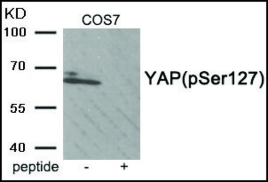 Anti-phospho-YAP (pSer127) antibody produced in rabbit affinity isolated antibody