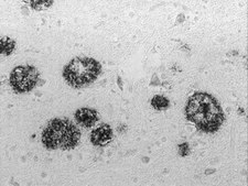 抗-淀粉样蛋白抗体，β 1-16，克隆DE2 culture supernatant, clone DE2, Chemicon®