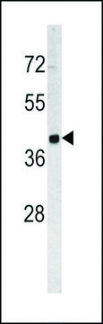 ANTI-TROP2 (CENTER) antibody produced in rabbit purified immunoglobulin, buffered aqueous solution