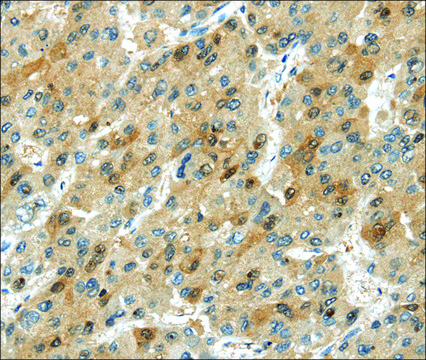 Anti-TRIB1 affinity isolated antibody