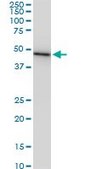 Monoclonal Anti-CMAS antibody produced in mouse clone 2E1, purified immunoglobulin, buffered aqueous solution