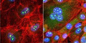 Anti-RRP8 Antibody, clone 5C7.1 clone 5C7.1, from mouse