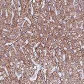 Anti-EI24 antibody produced in rabbit Prestige Antibodies® Powered by Atlas Antibodies, affinity isolated antibody, buffered aqueous glycerol solution