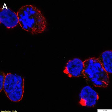 Anti-p-ZAP-70 (Tyr493) Antibody, clone 1F10 ZooMAb&#174; Rabbit Monoclonal recombinant, expressed in HEK 293 cells