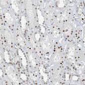 Anti-MCM9 antibody produced in rabbit Prestige Antibodies® Powered by Atlas Antibodies, affinity isolated antibody, buffered aqueous glycerol solution
