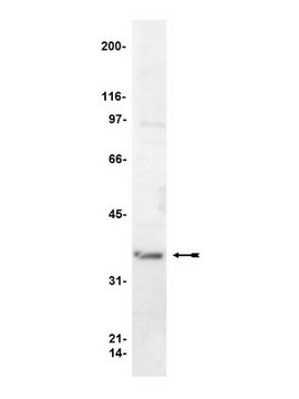 Anti-G&#946; Antibody serum, Upstate&#174;