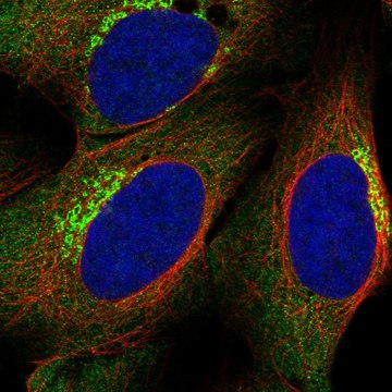 Anti-Mmp11 Antibody Produced In Rabbit Prestige Antibodies&#174; Powered by Atlas Antibodies, affinity isolated antibody, buffered aqueous glycerol solution