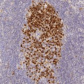 Anti-ELL3 antibody produced in rabbit Prestige Antibodies® Powered by Atlas Antibodies, affinity isolated antibody, buffered aqueous glycerol solution