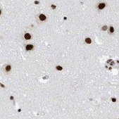 Anti-SF3A1 antibody produced in rabbit Prestige Antibodies® Powered by Atlas Antibodies, affinity isolated antibody, buffered aqueous glycerol solution