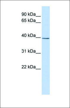 Anti-SETD3 antibody produced in rabbit affinity isolated antibody