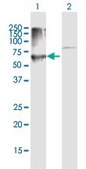 Anti-PRKCSH antibody produced in mouse purified immunoglobulin, buffered aqueous solution