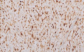 CDK4 (DCS-31) Mouse Monoclonal Antibody