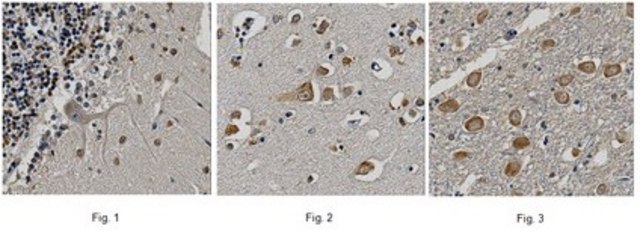 Anti-Neuronal acetylcholine receptor &#945;-7, clone 6F12.2 Antibody clone 6F12.2, from mouse