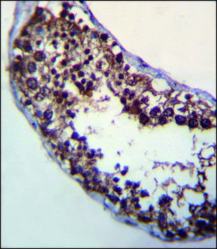 ANTI-POMT1 (C-TERM) antibody produced in rabbit IgG fraction of antiserum, buffered aqueous solution