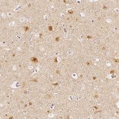 Anti-ARHGAP26 antibody produced in rabbit Prestige Antibodies® Powered by Atlas Antibodies, affinity isolated antibody, buffered aqueous glycerol solution