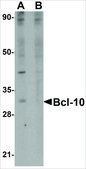 Anti-Bcl-10 antibody produced in rabbit affinity isolated antibody, buffered aqueous solution