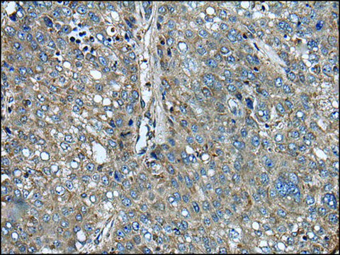 Anti-ARFGEF1 affinity isolated antibody