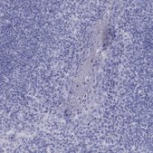 Anti-FSCN3 antibody produced in rabbit Prestige Antibodies® Powered by Atlas Antibodies, affinity isolated antibody, buffered aqueous glycerol solution