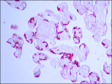 Anti-Transglutaminase-2 (C-terminal) antibody produced in rabbit ~1.5 mg/mL, affinity isolated antibody
